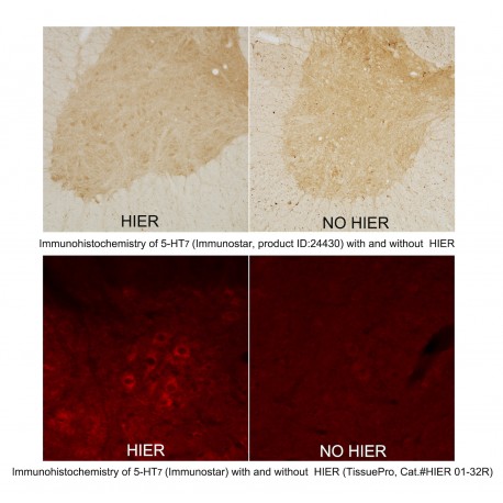 Heat Induced Epitope Retrieval